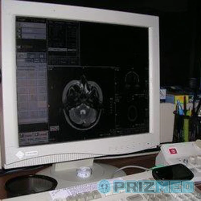 Toshiba Excelart 1.5T - Image 3